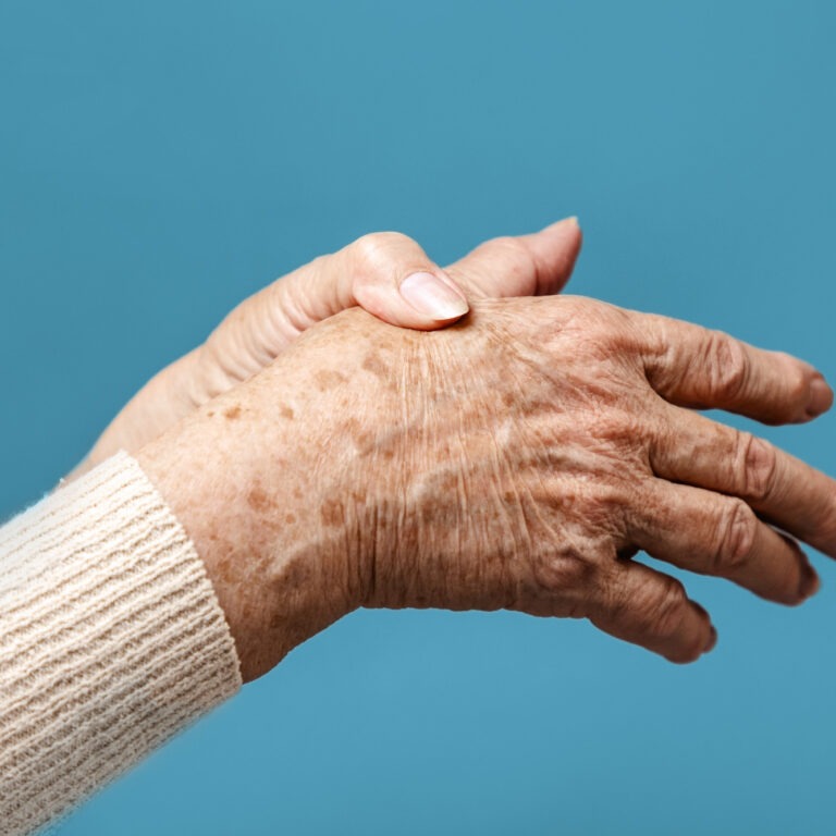 Senior lady applying pressure to her hand to alleviate arthritic pain