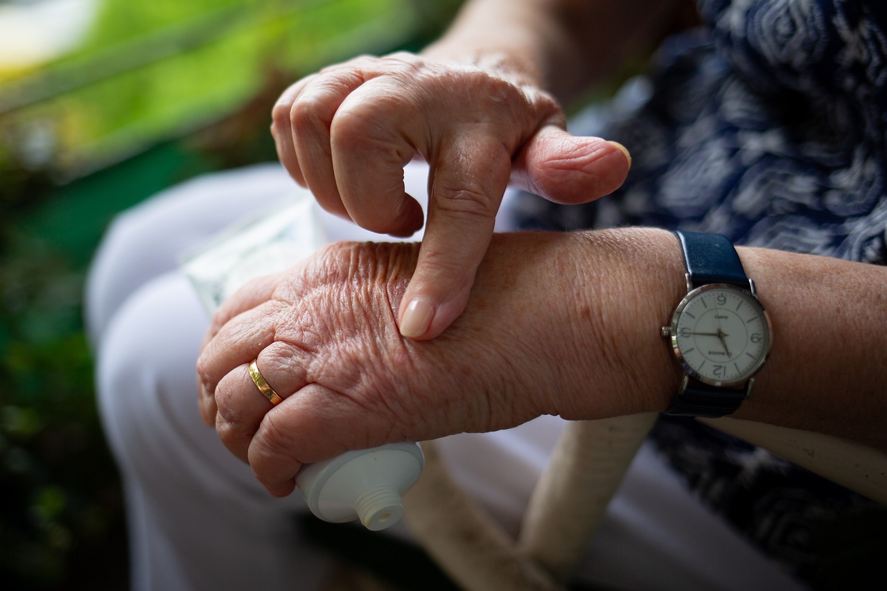 Senior woman applies arthritis cream to her swollen hand